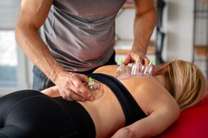 Image showing a physical therapist using cupping therapy on a client