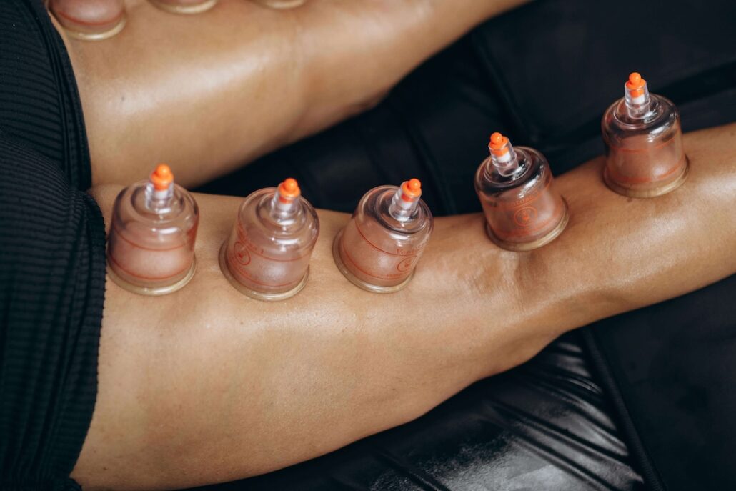 Cupping for recovery for athletic men